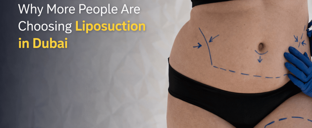 Shaping Confidence: Why More People Are Choosing Liposuction in Dubai